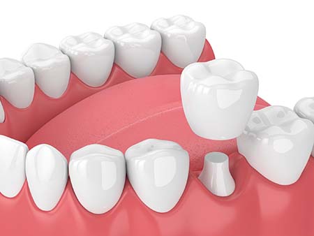 Apple Family Dental -