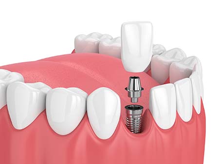 Apple Family Dental -