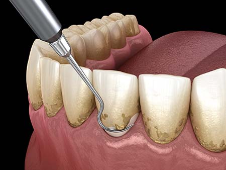 Apple Family Dental -