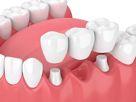 Apple Family Dental -